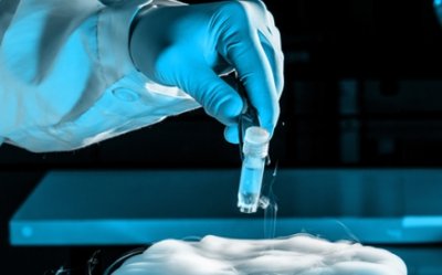 Особенности химиотерапии при раке яичка