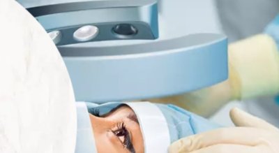 Лечение вторичной катаракты лазером